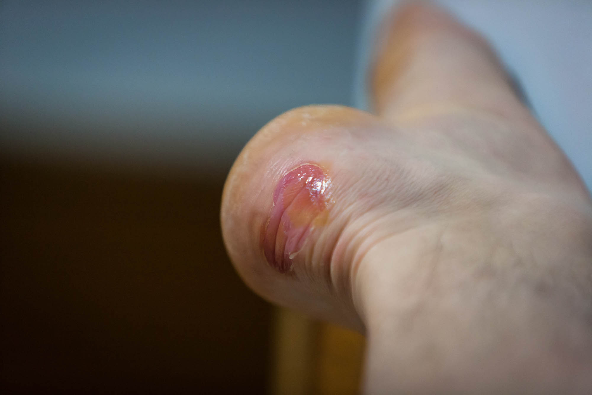 my foot after the walk from Dingzhou to Cheng'anpu